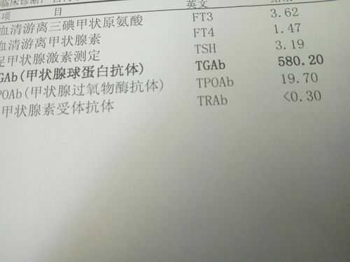 孕期检查甲状腺球蛋白抗体和甲状腺过氧化物酶抗体高正常吗,孕期抗甲状腺过氧化物酶抗体高对胎儿有影响吗 第2张 孕期检查甲状腺球蛋白抗体和甲状腺过氧化物酶抗体高正常吗,孕期抗甲状腺过氧化物酶抗体高对胎儿有影响吗 第2张