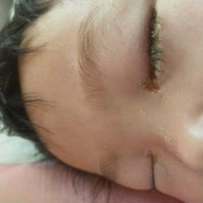 孕妇5个月胎儿图片(5个月宝宝眼睛眼屎多) 第3张 孕妇5个月胎儿图片(5个月宝宝眼睛眼屎多) 第3张