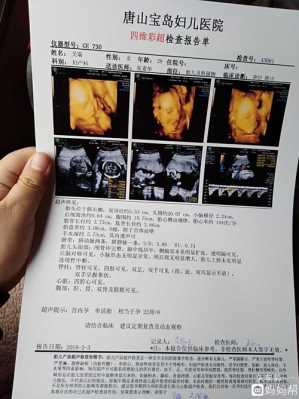 心脏彩超检查什么的,四维过了有必要做心脏彩超吗  第1张