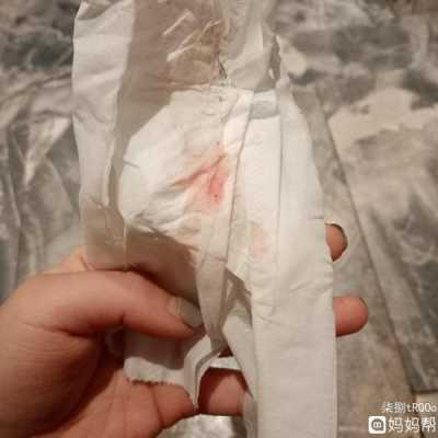 孕期出鲜血(孕期出鲜血是怎么回事) 第2张 孕期出鲜血(孕期出鲜血是怎么回事) 第2张
