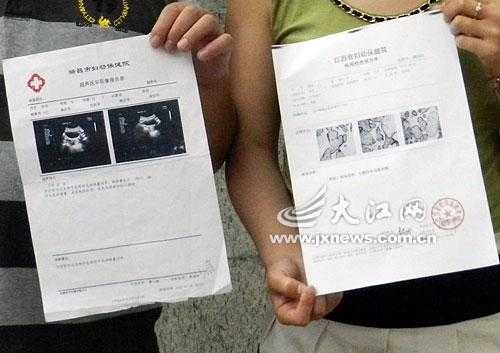 胎儿偏左侧是什么原因(怀孕七个月了,胎儿总在左边动,右边不动,是什么原因呢) 第1张 胎儿偏左侧是什么原因(怀孕七个月了,胎儿总在左边动,右边不动,是什么原因呢) 第1张