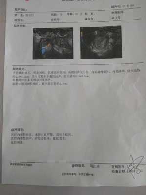 孕6周，查说宫腔积血，要注意啥,子宫有积血会影响胎儿发育正常吗  第2张
