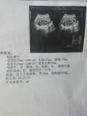 胎儿偏小一个月的危险(胎儿偏小一个月的危险性大吗) 第1张 胎儿偏小一个月的危险(胎儿偏小一个月的危险性大吗) 第1张