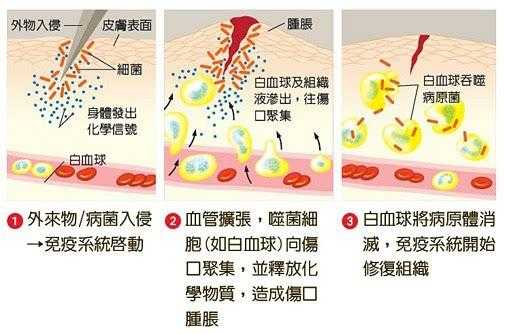 胎儿脑炎(新生儿脑炎怎么办) 第3张 胎儿脑炎(新生儿脑炎怎么办) 第3张