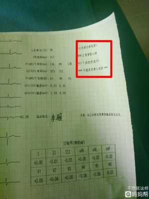孕期心电图异常（孕期心电图异常是什么原因）  第1张