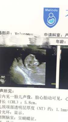 胎儿鼻子发育(胎儿鼻子发育多少周) 第2张 胎儿鼻子发育(胎儿鼻子发育多少周) 第2张