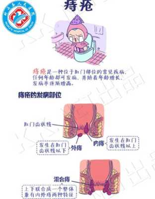 孕妇痔疮出来了要怎么办好,孕期内痔疮大便出血怎么办 第3张 孕妇痔疮出来了要怎么办好,孕期内痔疮大便出血怎么办 第3张