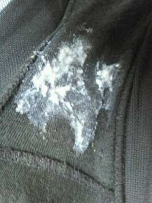 为啥怀孕之后,阴部有股臭臭的很难闻的味道, 第2张 为啥怀孕之后,阴部有股臭臭的很难闻的味道, 第2张
