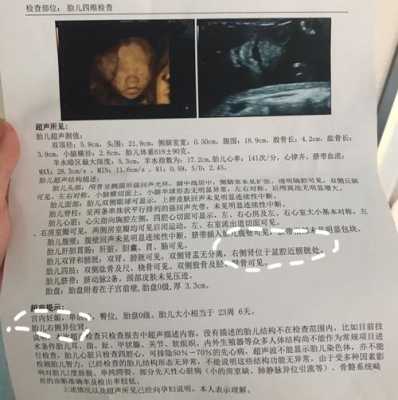 胎儿左肾偏小怎么办,胎儿肾肥大是怎么回事 第2张 胎儿左肾偏小怎么办,胎儿肾肥大是怎么回事 第2张