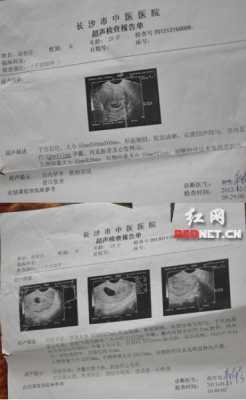 怀孕三个月做b超检查说宝宝爱动,怎么办,孕妇胎儿好动什么原因 第3张 怀孕三个月做b超检查说宝宝爱动,怎么办,孕妇胎儿好动什么原因 第3张