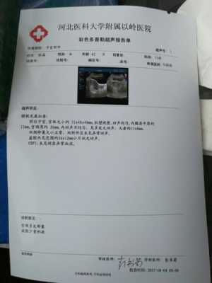 孕期胸积水(我怀孕了陶氏腔积液是怎么回事) 第1张 孕期胸积水(我怀孕了陶氏腔积液是怎么回事) 第1张