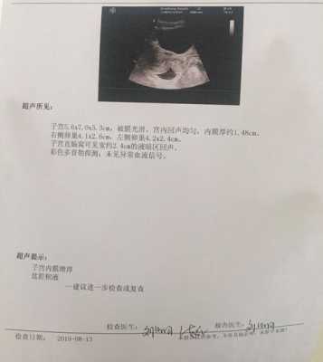 孕期胸积水(我怀孕了陶氏腔积液是怎么回事) 第2张 孕期胸积水(我怀孕了陶氏腔积液是怎么回事) 第2张