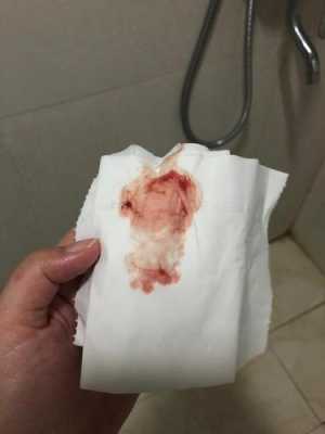 怀孕三个多月同房流血是怎么回事,孕期行房出血怎么办 第2张 怀孕三个多月同房流血是怎么回事,孕期行房出血怎么办 第2张
