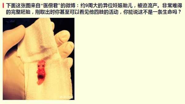 被打掉的胎儿(女朋友怀孕了把孩子打掉怎么办) 第3张 被打掉的胎儿(女朋友怀孕了把孩子打掉怎么办) 第3张