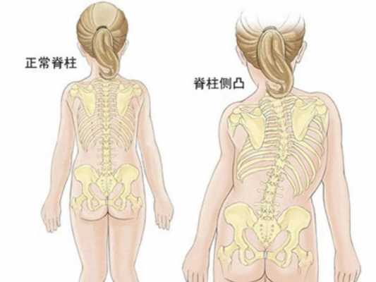 畸形胎儿能要吗(半椎体畸形胎儿能要吗) 第3张 畸形胎儿能要吗(半椎体畸形胎儿能要吗) 第3张
