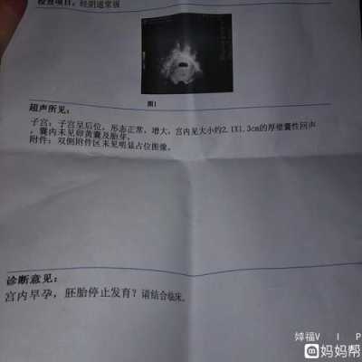 胎儿期停胎(怀孕有胎心胎芽还会引起停胎吗) 第2张 胎儿期停胎(怀孕有胎心胎芽还会引起停胎吗) 第2张