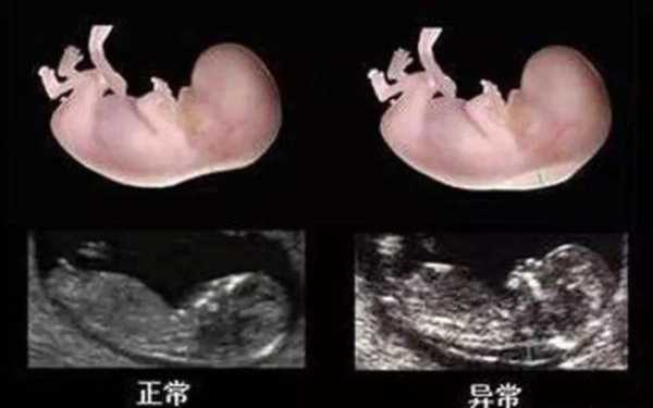 怎样检查小孩智商,胎儿智力筛查是做什么检查 第2张 怎样检查小孩智商,胎儿智力筛查是做什么检查 第2张