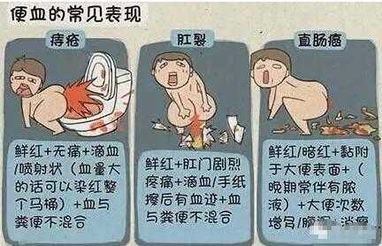 孕期屁眼出血(孕期便秘肛门出血是怎么回事的呢) 第1张 孕期屁眼出血(孕期便秘肛门出血是怎么回事的呢) 第1张