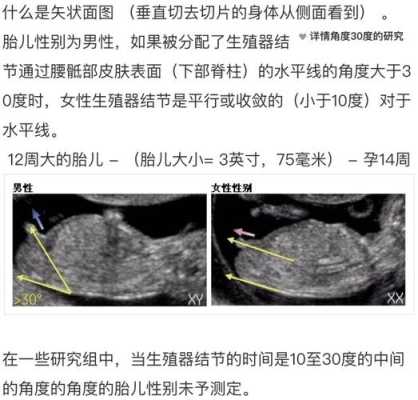 胎儿孕期发育图(胎儿的甲状腺在怀孕多少周后开始发育?胎儿的甲状腺素从怀孕多少周开始从母体吸收) 第2张 胎儿孕期发育图(胎儿的甲状腺在怀孕多少周后开始发育?胎儿的甲状腺素从怀孕多少周开始从母体吸收) 第2张