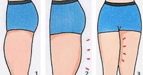 如何让大腿变粗,孕期大腿变粗能恢复吗  第1张