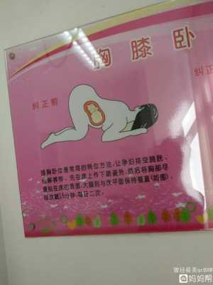 胎位不正的文案,胎儿斜臀位怎么办 第2张 胎位不正的文案,胎儿斜臀位怎么办 第2张