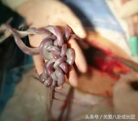 七月胎儿图(七月胎儿图片大全) 第3张 七月胎儿图(七月胎儿图片大全) 第3张