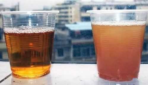 孕期尿液发黄(孕期尿液发黄正常吗) 第3张 孕期尿液发黄(孕期尿液发黄正常吗) 第3张