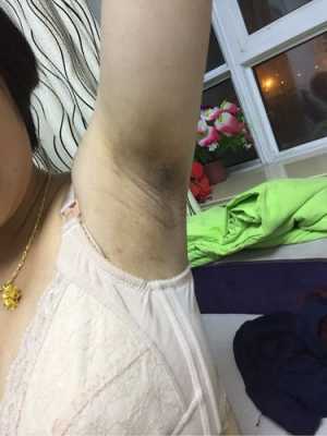 孕期腋窝有味（孕期腋窝有味道怎么办）  第3张