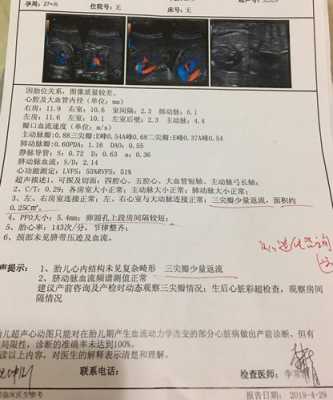 胎儿三尖瓣反流是什么意思,胎儿心血管异常怎么办 第1张 胎儿三尖瓣反流是什么意思,胎儿心血管异常怎么办 第1张