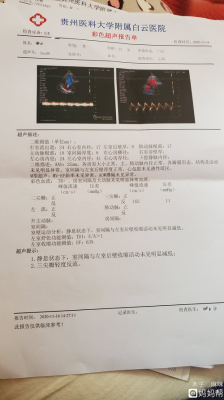 胎儿三尖瓣反流是什么意思,胎儿心血管异常怎么办 第2张 胎儿三尖瓣反流是什么意思,胎儿心血管异常怎么办 第2张