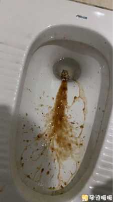 孕期胃出血(孕期胃出血怎么办) 第2张 孕期胃出血(孕期胃出血怎么办) 第2张