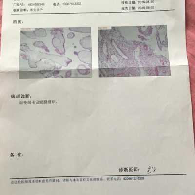 胚胎病理检查费用,胎儿筛查是什么意思 第2张 胚胎病理检查费用,胎儿筛查是什么意思 第2张