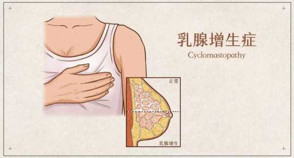 为什么生了孩子的女人身材丰腴,孕期大乳腺结节  第2张