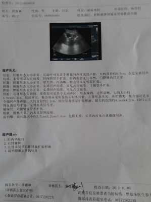 胎儿双肾囊肿(胎儿双肾囊肿怎么办) 第2张 胎儿双肾囊肿(胎儿双肾囊肿怎么办) 第2张