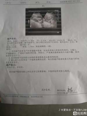孕19周做二维彩超可以检查什么多吗,19周胎儿彩超标准数值 第2张 孕19周做二维彩超可以检查什么多吗,19周胎儿彩超标准数值 第2张