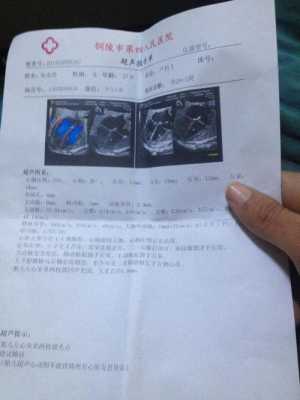 如何让胎儿强光点消失(孕期唐筛低风险左心室有强光点怎么办) 第2张 如何让胎儿强光点消失(孕期唐筛低风险左心室有强光点怎么办) 第2张