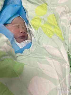 35周胎儿动的厉害(怀孕35周胎儿生下来是什么样的呢) 第2张 35周胎儿动的厉害(怀孕35周胎儿生下来是什么样的呢) 第2张