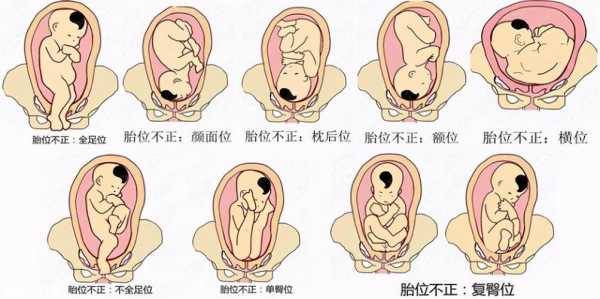 RSA是什么胎位,孕期胎位变化图 第2张 RSA是什么胎位,孕期胎位变化图 第2张