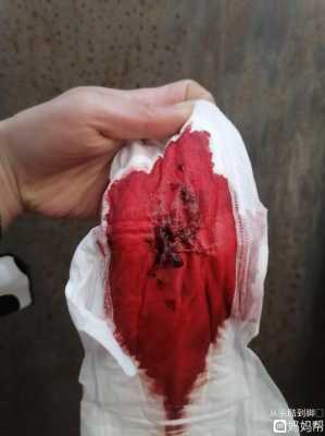孕期流红色血(孕妇白带带一点点血丝是见红了要生的情况吗) 第2张 孕期流红色血(孕妇白带带一点点血丝是见红了要生的情况吗) 第2张