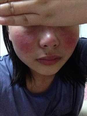 孕期脸变胖(孕妇脸和手也肿了,怎么办) 第2张 孕期脸变胖(孕妇脸和手也肿了,怎么办) 第2张