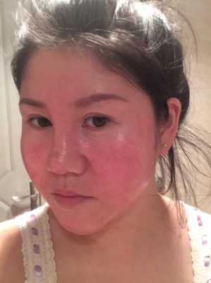 孕期脸变胖(孕妇脸和手也肿了,怎么办) 第1张 孕期脸变胖(孕妇脸和手也肿了,怎么办) 第1张