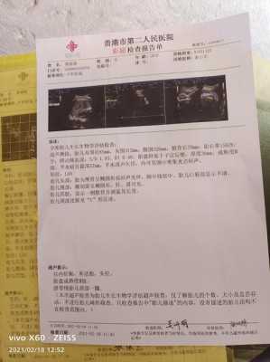 胎儿脖子上有U型压痕(胎儿脖子上有U型压痕) 第2张 胎儿脖子上有U型压痕(胎儿脖子上有U型压痕) 第2张
