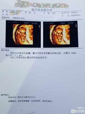 11周的胎儿会动吗(怀孕11周了头臀径大概多少是正常的) 第2张 11周的胎儿会动吗(怀孕11周了头臀径大概多少是正常的) 第2张