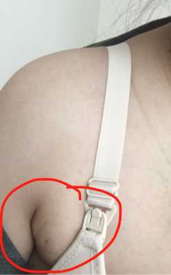 孕期副乳图(孕期副乳长大怎么办) 第1张 孕期副乳图(孕期副乳长大怎么办) 第1张