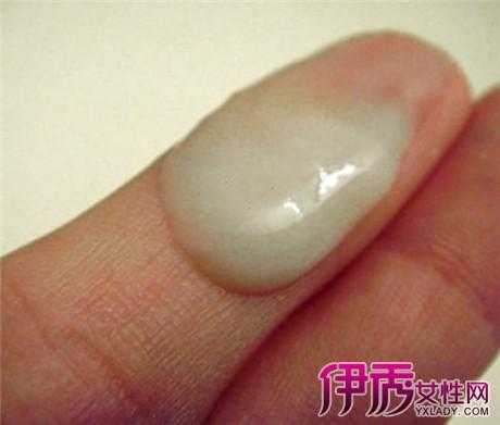 孕期白带脓球(脓性白带是怎样的) 第2张 孕期白带脓球(脓性白带是怎样的) 第2张