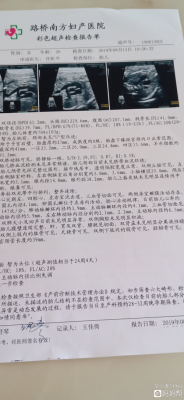 胎儿主动脉大于肺动脉(胎儿肺动脉与主动脉内径比例偏小是什么意思) 第1张 胎儿主动脉大于肺动脉(胎儿肺动脉与主动脉内径比例偏小是什么意思) 第1张