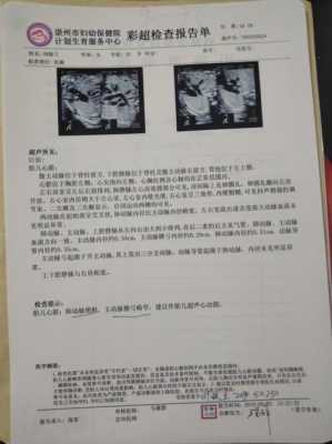胎儿主动脉大于肺动脉(胎儿肺动脉与主动脉内径比例偏小是什么意思) 第2张 胎儿主动脉大于肺动脉(胎儿肺动脉与主动脉内径比例偏小是什么意思) 第2张
