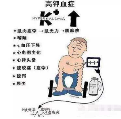孕妇钾高对胎儿有影响(孕妇钾高对胎儿有影响) 第1张 孕妇钾高对胎儿有影响(孕妇钾高对胎儿有影响) 第1张