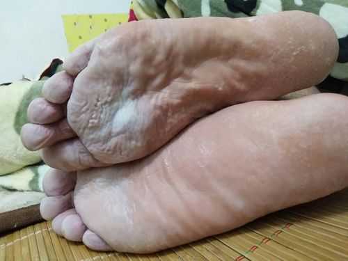 孕期脚变臭(孕妇放屁很臭是怎么回事,是不是消化不好导致的呀) 第1张 孕期脚变臭(孕妇放屁很臭是怎么回事,是不是消化不好导致的呀) 第1张