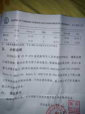亲子鉴定结果准确吗,胎儿亲子鉴定准确率高吗 第2张 亲子鉴定结果准确吗,胎儿亲子鉴定准确率高吗 第2张